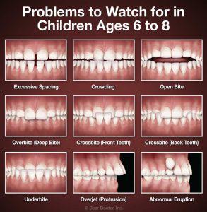 Orthodontic problems in children: Merced Orthodontists
